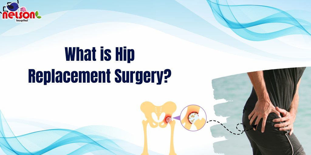 Hip Replacement Surgery
