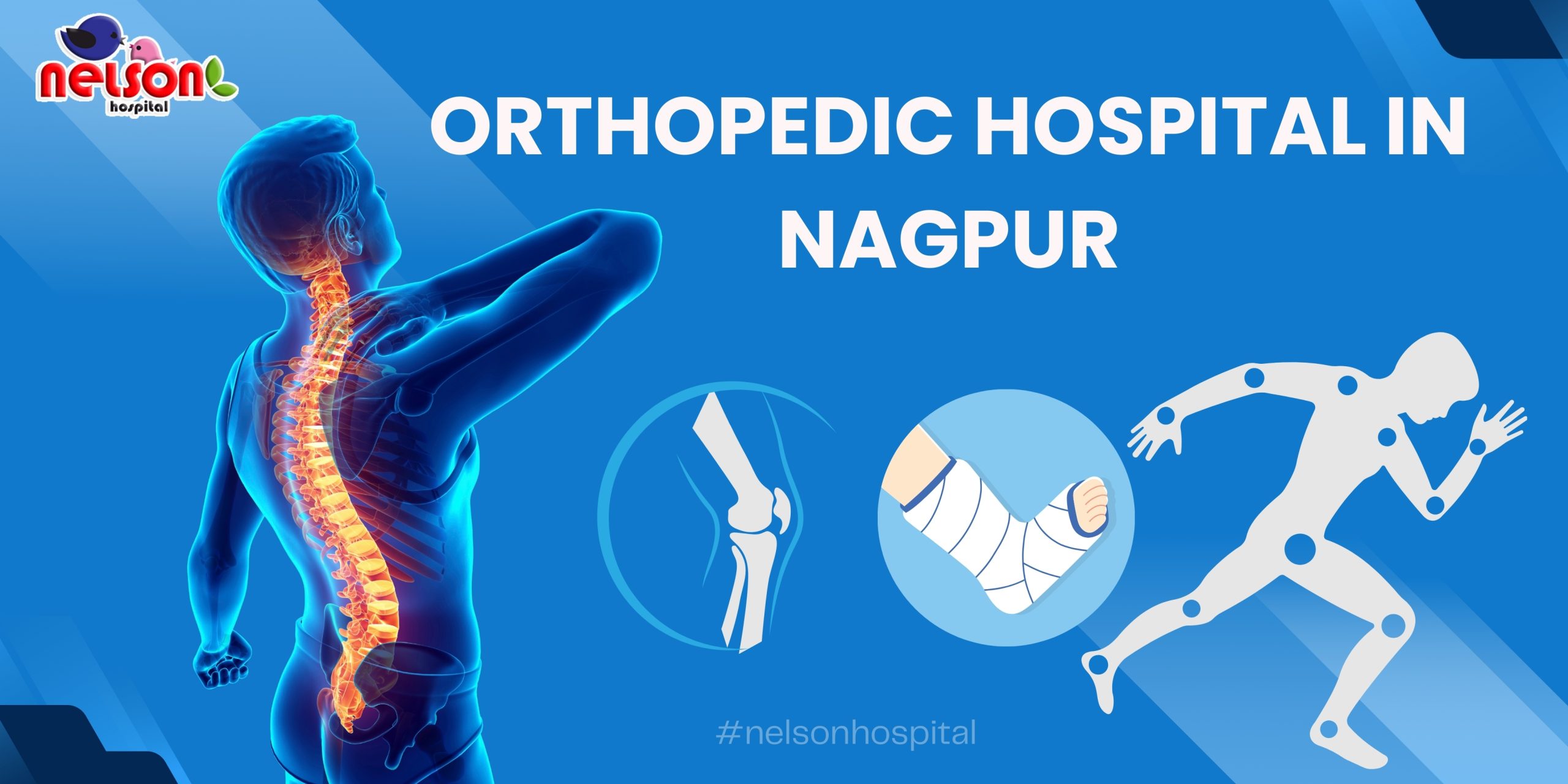 Best Orthopedic Hospital in Nagpur