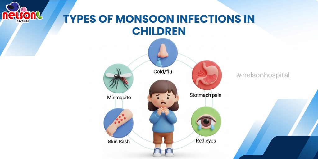 monsoon infection